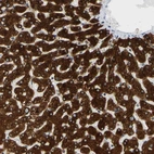 Anti-MGST2 Antibody