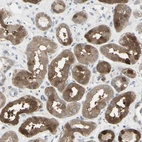 Immunohistochemical staining of human kidney shows moderate cytoplasmic positivity in cells in tubules.