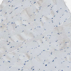 Immunohistochemical staining of human skeletal muscle shows no positivity in myocytes as expected.