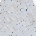 Immunohistochemical staining of human skeletal muscle shows no positivity in myocytes as expected.