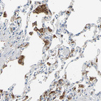 Anti-FCGR2A Antibody