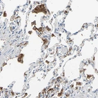 Anti-FCGR2A Antibody