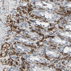 Immunohistochemical staining of human rectum shows strong cytoplasmic/membranous positivity in lymphoid cells.
