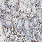 Immunohistochemical staining of human stomach shows moderate cytoplasmic/membranous positivity in lymphoid cells.