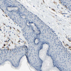 Immunohistochemical staining of human skin shows no positivity in squamous epithelial cells as expected.