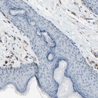 Immunohistochemical staining of human skin shows no positivity in squamous epithelial cells as expected.