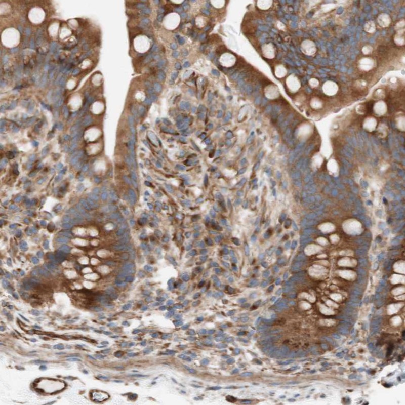 Anti-C1orf43 Antibody