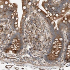 Anti-C1orf43 Antibody