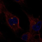 Anti-EXTL1 Antibody