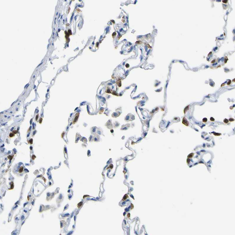 Anti-ABHD3 Antibody