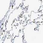 Anti-ABHD3 Antibody