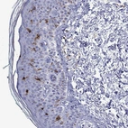 Immunohistochemical staining of human skin shows strong granular cytoplasmic positivity in Langerhans cells.
