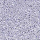 Anti-CD1A Antibody