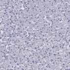 Immunohistochemical staining of human liver shows no positivity in hepatocytes as expected.