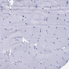 Immunohistochemical staining of human skeletal muscle shows no positivity in myocytes as expected.