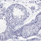 Immunohistochemical staining of human testis shows no positivity in cells in seminiferous ducts as expected.