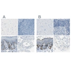 Immunohistochemical staining of human cerebral cortex, lymph node, skin and testis using Anti-DCT antibody HPA010743 (A) shows similar protein distribution across tissues to independent antibody HPA010800 (B).