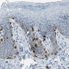 Immunohistochemical staining of human skin shows cytoplasmic positivity in squamous epithelial cells.