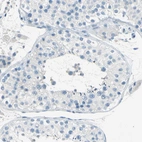 Immunohistochemical staining of human testis shows no positivity in cells in seminiferous ducts as expected.