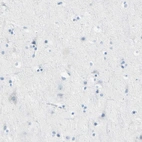 Immunohistochemical staining of human cerebral cortex shows no positivity in neurons as expected.