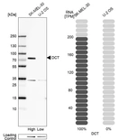 Western blot analysis in human cell line SK-MEL-30 and human cell line U-2 OS.