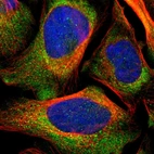 Immunofluorescent staining of human cell line U-2 OS shows localization to cytosol.