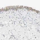 Immunohistochemical staining of human urinary bladder shows moderate membranous positivity in urothelial cells.