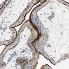 Anti-NECTIN4 Antibody