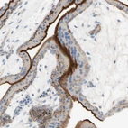 Immunohistochemical staining of human placenta shows moderate membranous positivity in trophoblastic cells.