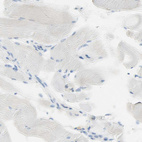 Immunohistochemical staining of human skeletal muscle shows no positivity in myocytes as expected.