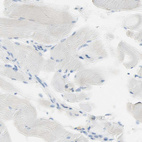 Anti-NECTIN4 Antibody