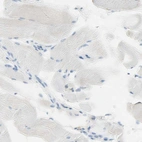 Immunohistochemical staining of human skeletal muscle shows no positivity in myocytes as expected.