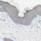 Immunohistochemical staining of human skin shows moderate membranous positivity in keratinocytes.
