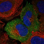 Immunofluorescent staining of human cell line U-2 OS shows localization to plasma membrane.
