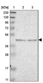 Lane 1: Marker [kDa] 230, 130, 95, 72, 56, 36, 28, 17, 11_br/_Lane 2: Human cell line RT-4_br/_Lane 3: Human cell line U-251MG sp