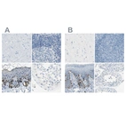 Immunohistochemical staining of human cerebral cortex, lymph node, skin and testis using Anti-DCT antibody HPA010800 (A) shows similar protein distribution across tissues to independent antibody HPA010743 (B).