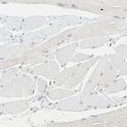 Immunohistochemical staining of human skeletal muscle shows low expression as expected.