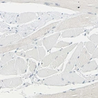 Immunohistochemical staining of human skeletal muscle shows low expression as expected.