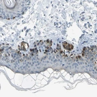 Immunohistochemical staining of human skin shows high expression.