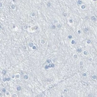 Immunohistochemical staining of human cerebral cortex using Anti-DCT antibody HPA010800.