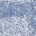 Immunohistochemical staining of human lymph node using Anti-DCT antibody HPA010800.