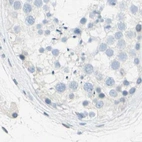 Immunohistochemical staining of human testis using Anti-DCT antibody HPA010800.