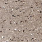 Anti-IGSF9B Antibody