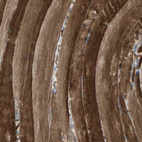 Immunohistochemical staining of human skeletal muscle shows strong cytoplasmic positivity in myocytes.
