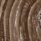 Immunohistochemical staining of human skeletal muscle shows strong cytoplasmic positivity in myocytes.