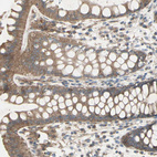Immunohistochemical staining of human rectum shows moderate cytoplasmic positivity in glandular cells.