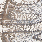 Immunohistochemical staining of human rectum shows moderate cytoplasmic positivity in glandular cells.