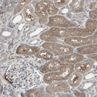 Immunohistochemical staining of human kidney shows moderate cytoplasmic positivity in cells in tubules.