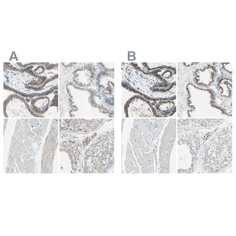 Anti-B4GALT1 Antibody