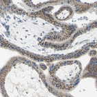 Immunohistochemical staining of human placenta shows strong granular cytoplasmic positivity in trophoblastic cells.